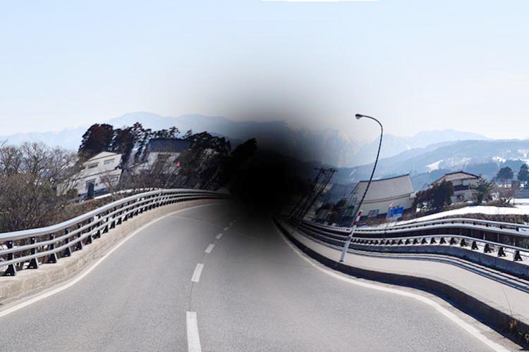 加齢性黄斑変性症のイメージ写真