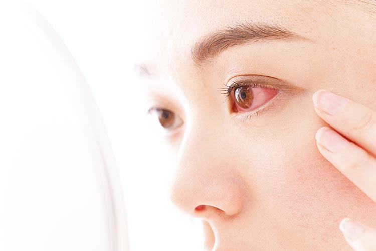 外眼部疾患のイメージ写真